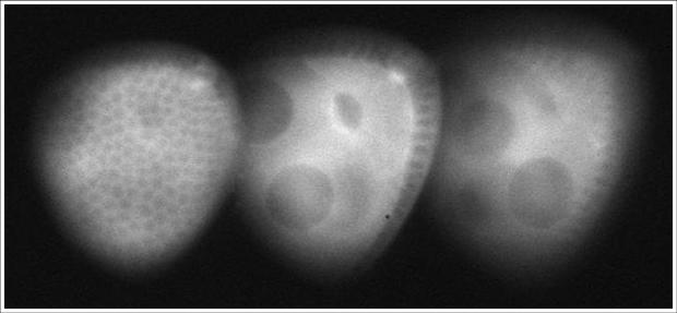 3D fluorescence imaging of a Drosophila oocyte